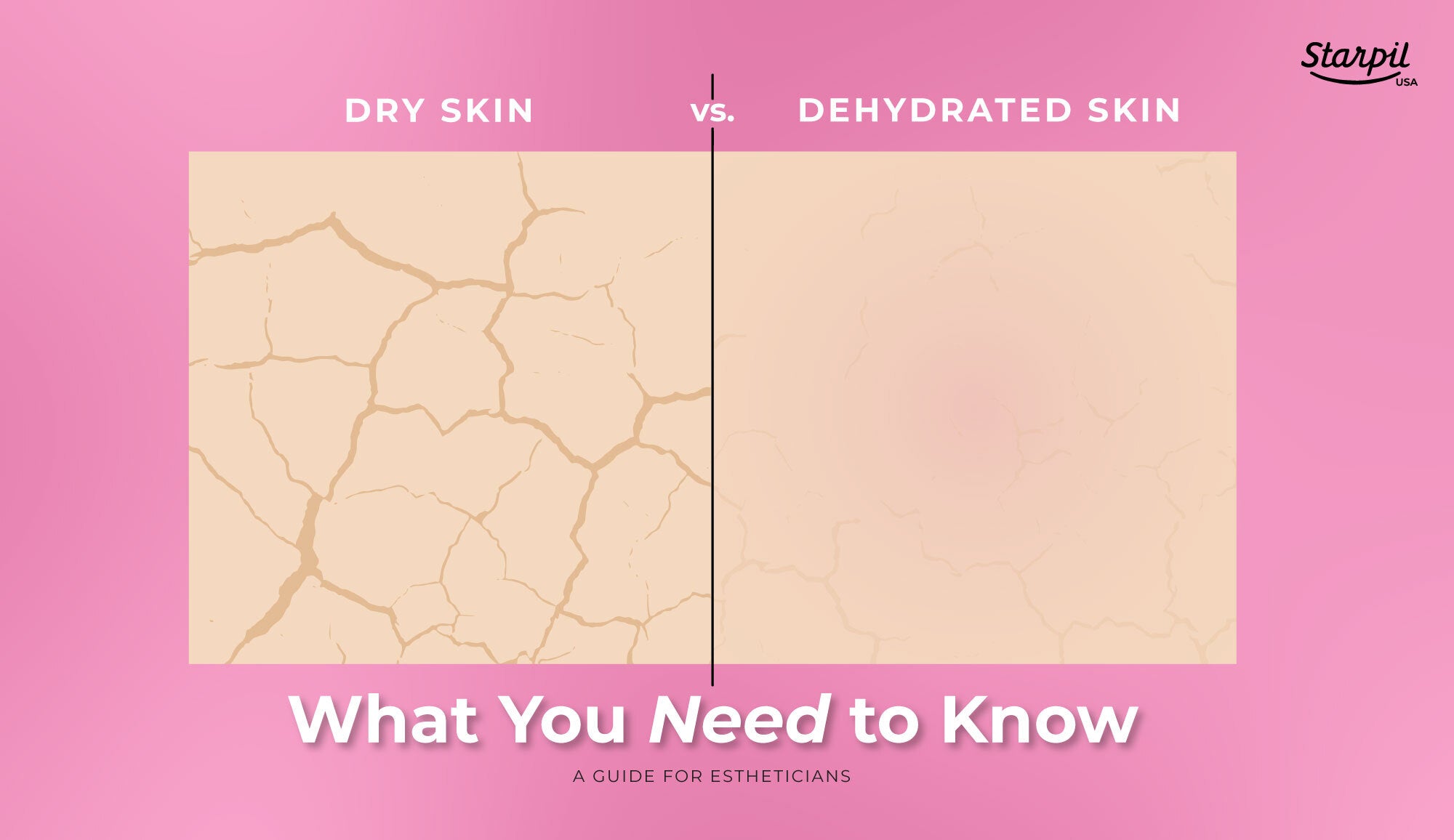 Working with dry vs dehydrated skin