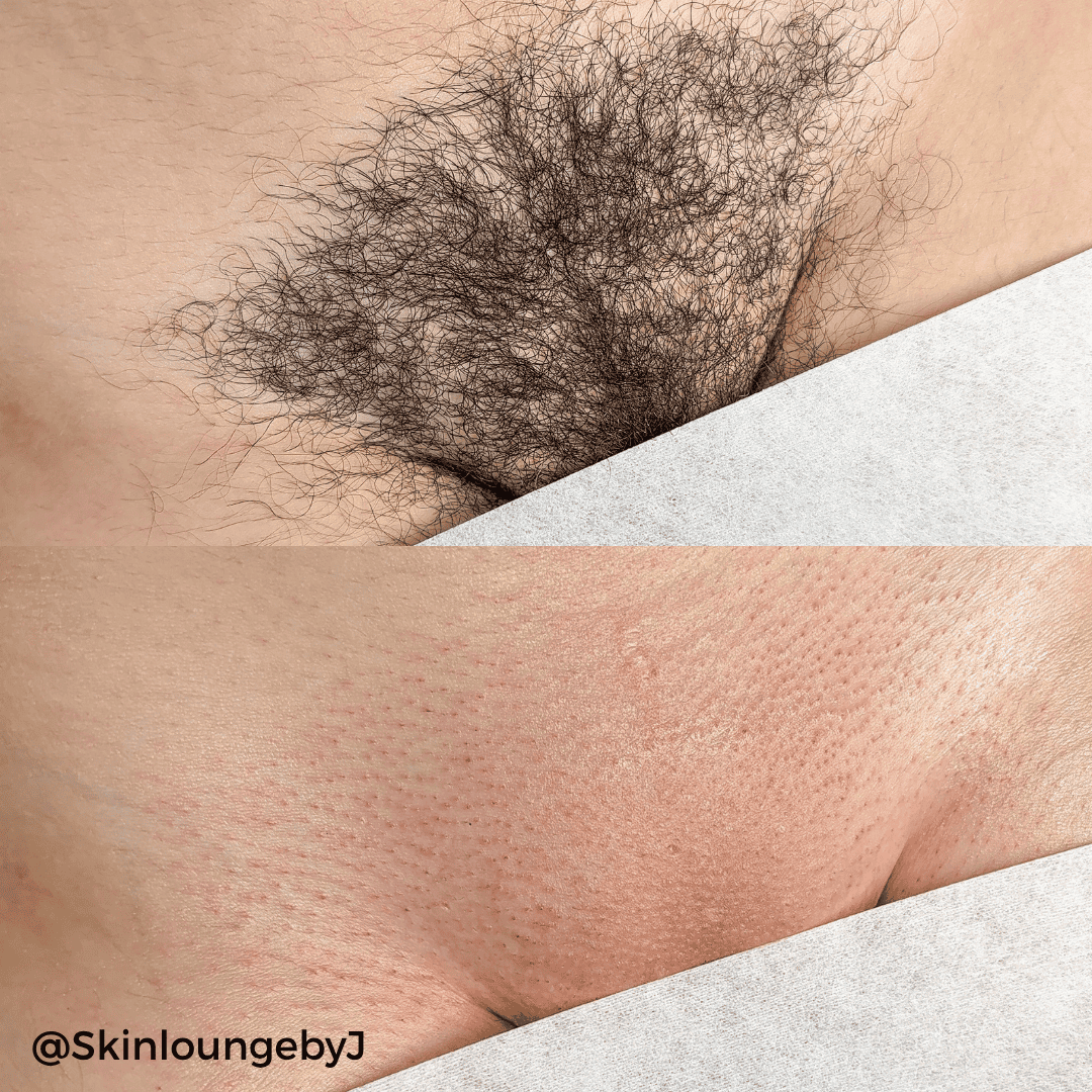 Starsoft Film Hard Wax Tablets - 2.2lb