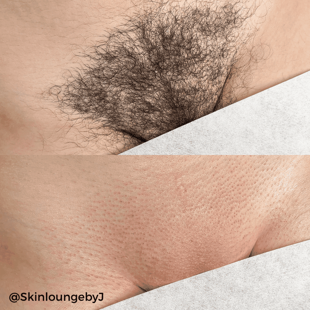 Starsoft Film Hard Wax Tablets - 2.2lb