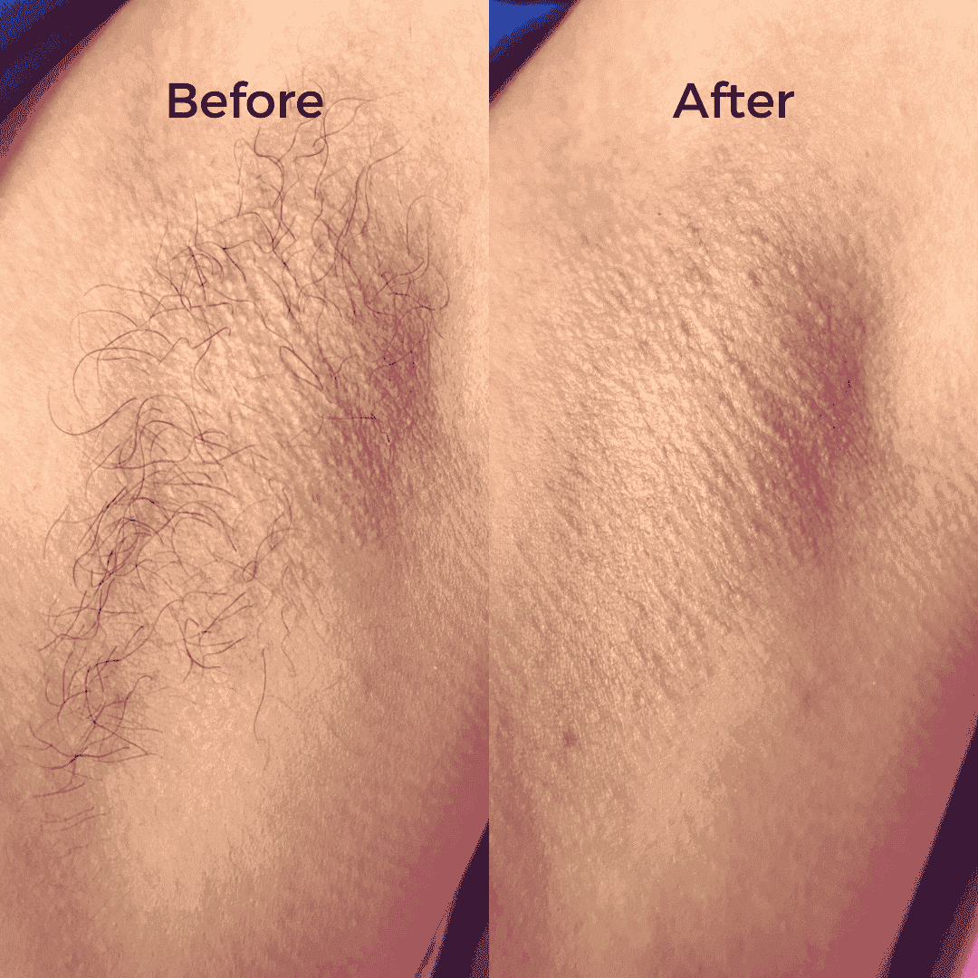 Full Body Waxing Kits