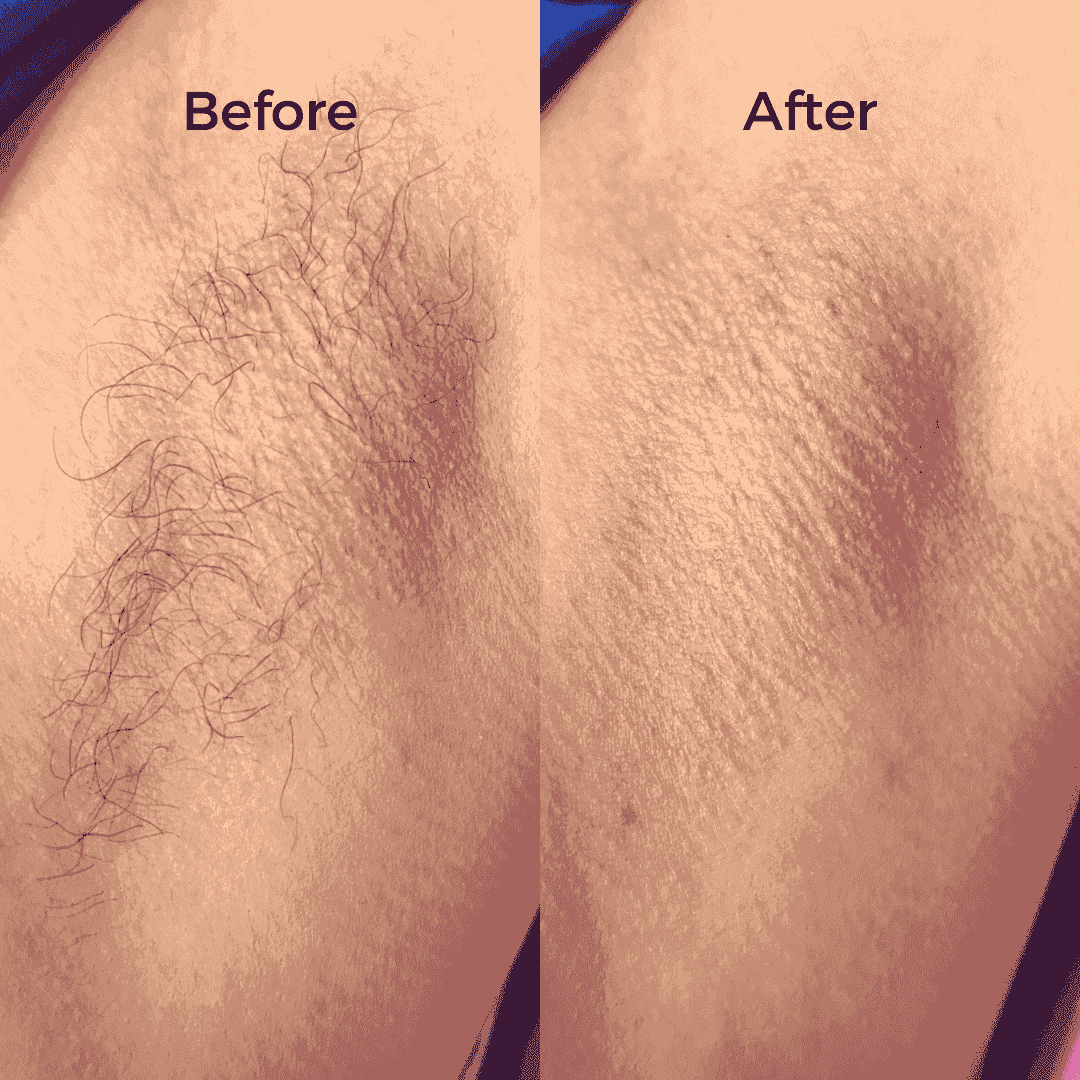 Full Body Waxing Kits