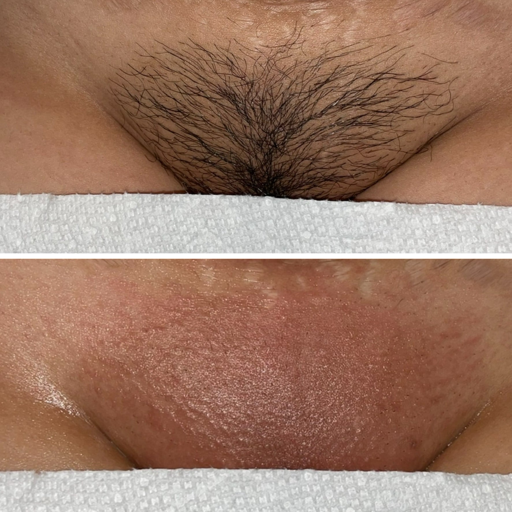 Brazilian before and after, warm mid skin tone
