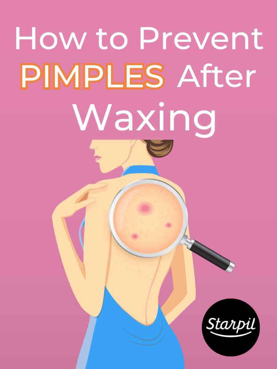 How to Avoid Acne After Waxing