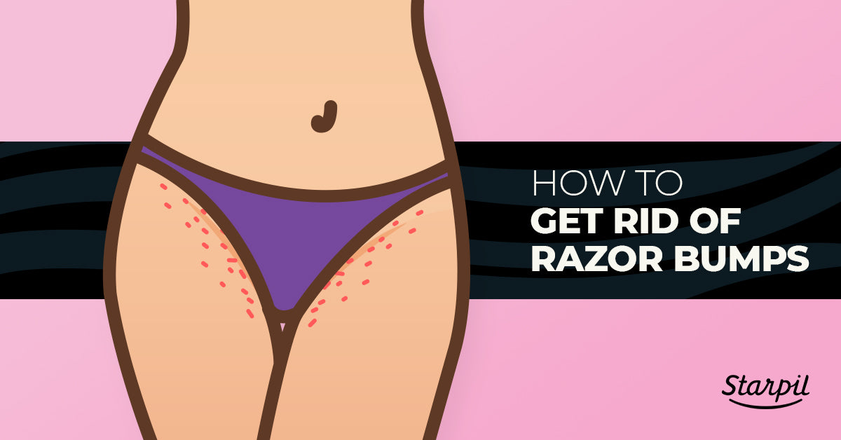 How to Get Rid of Razor Bumps