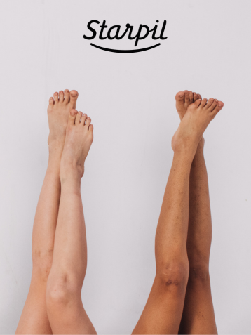 Skin Lifting from Waxing | The Complete Guide