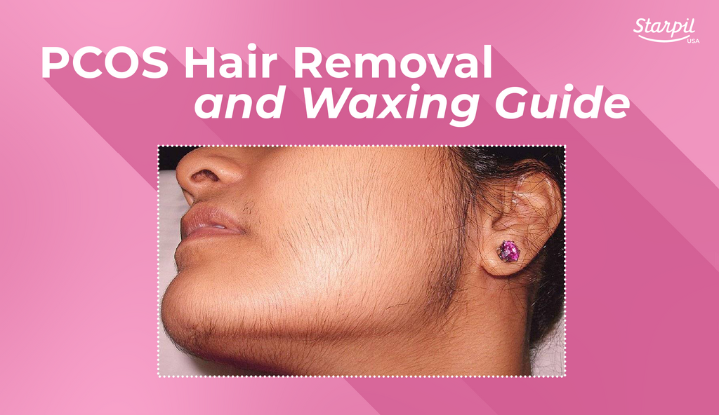 PCOS Hair Removal and Waxing Guide
