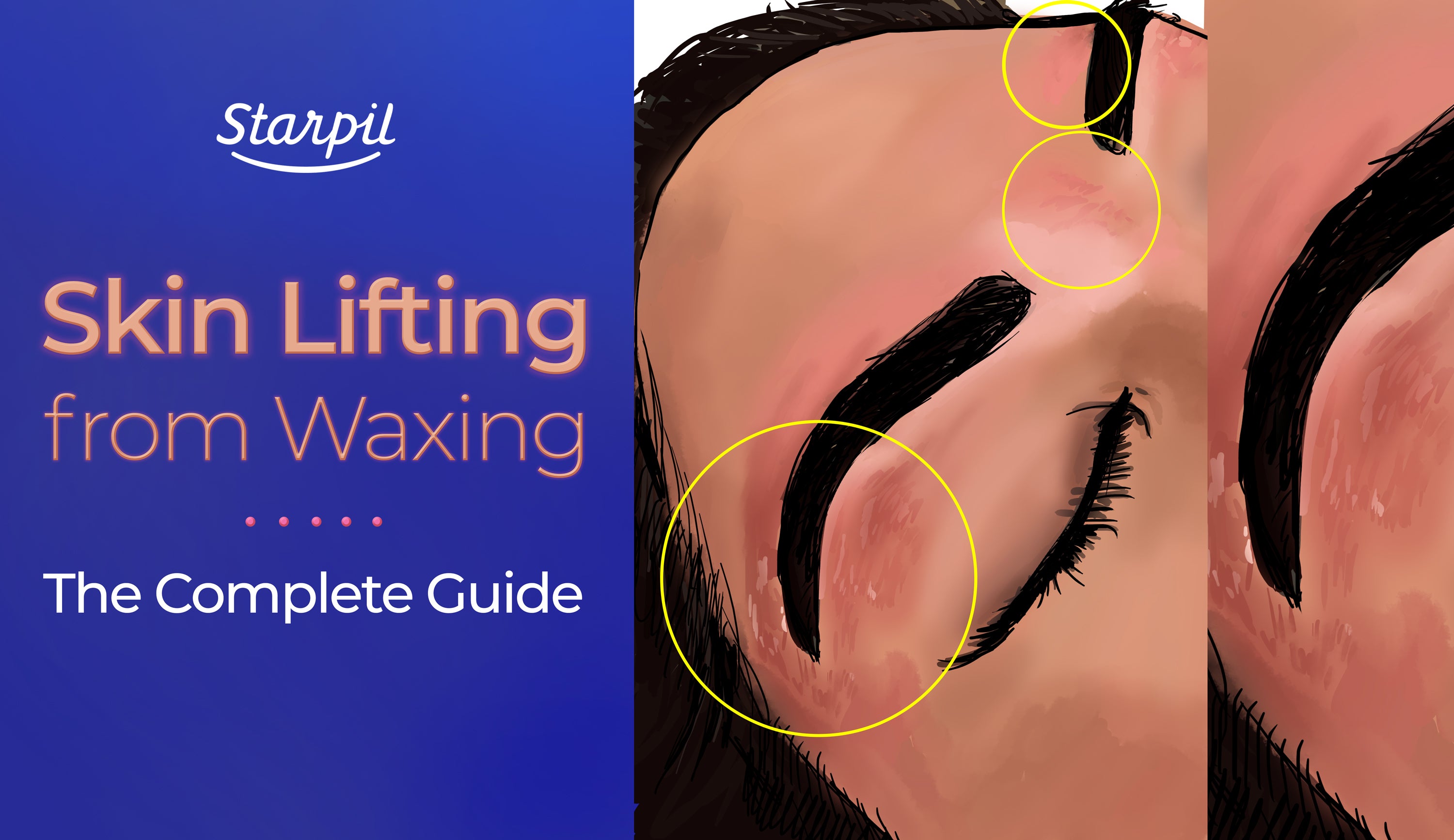 Skin Lifting from Waxing, The Complete Guide