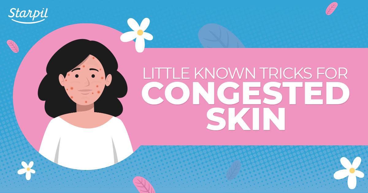 Congested Skin Tips & Tricks