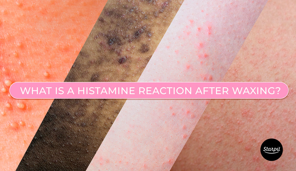 Histamine Reactions from waxing