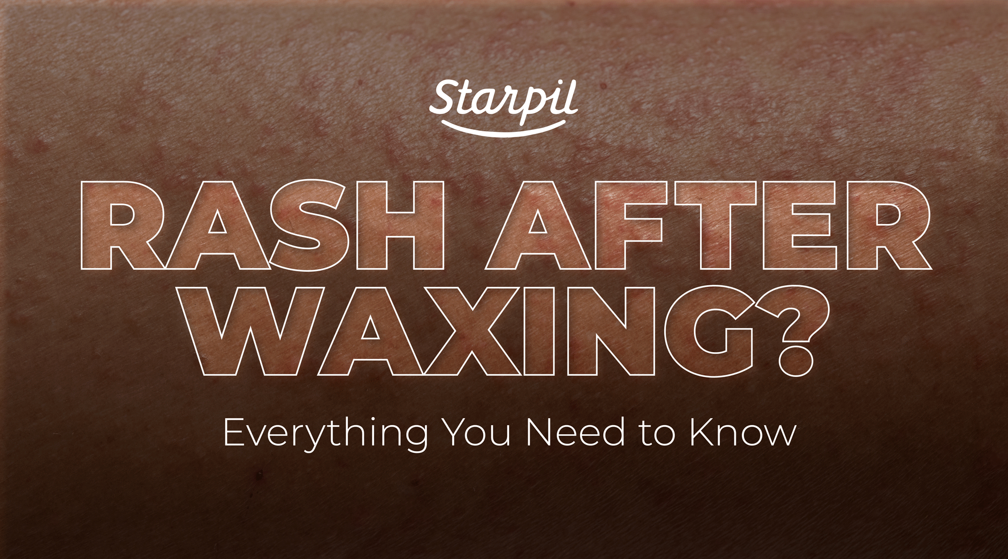Rashes After Waxing? What You Need to Know