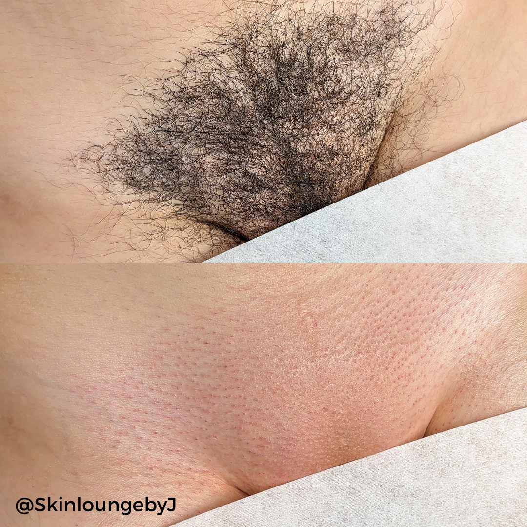 StarFLEX Malva Ultra-Flexible Hard Wax (1lb - 22lb)