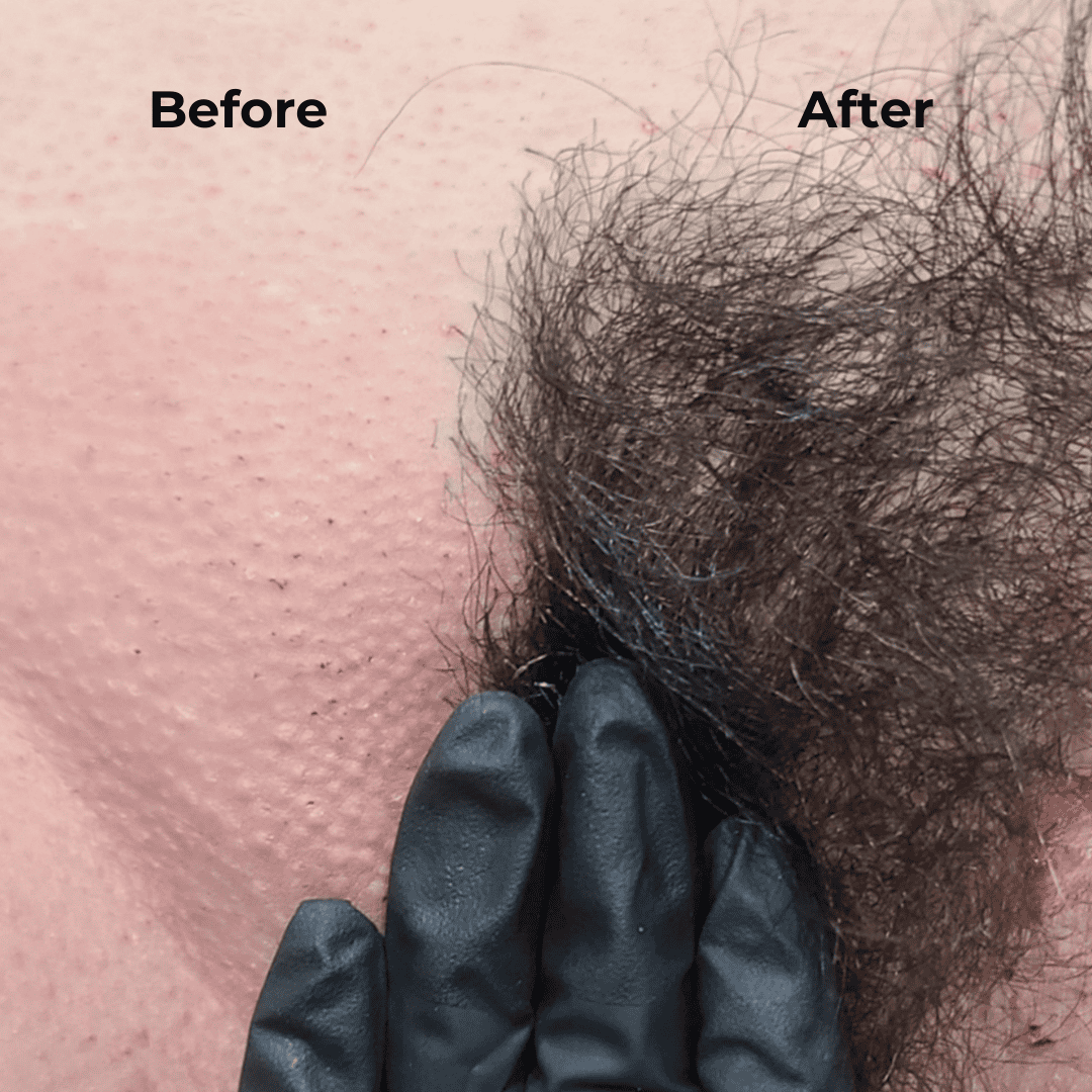 StarFlex Malva Hard Wax Sample